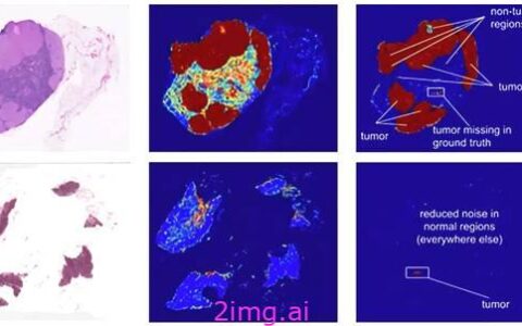谷歌 AI：医疗影像诊断的新突破