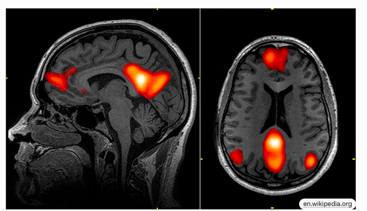 成为天才的窍门--大脑默认模式网络（DMN）